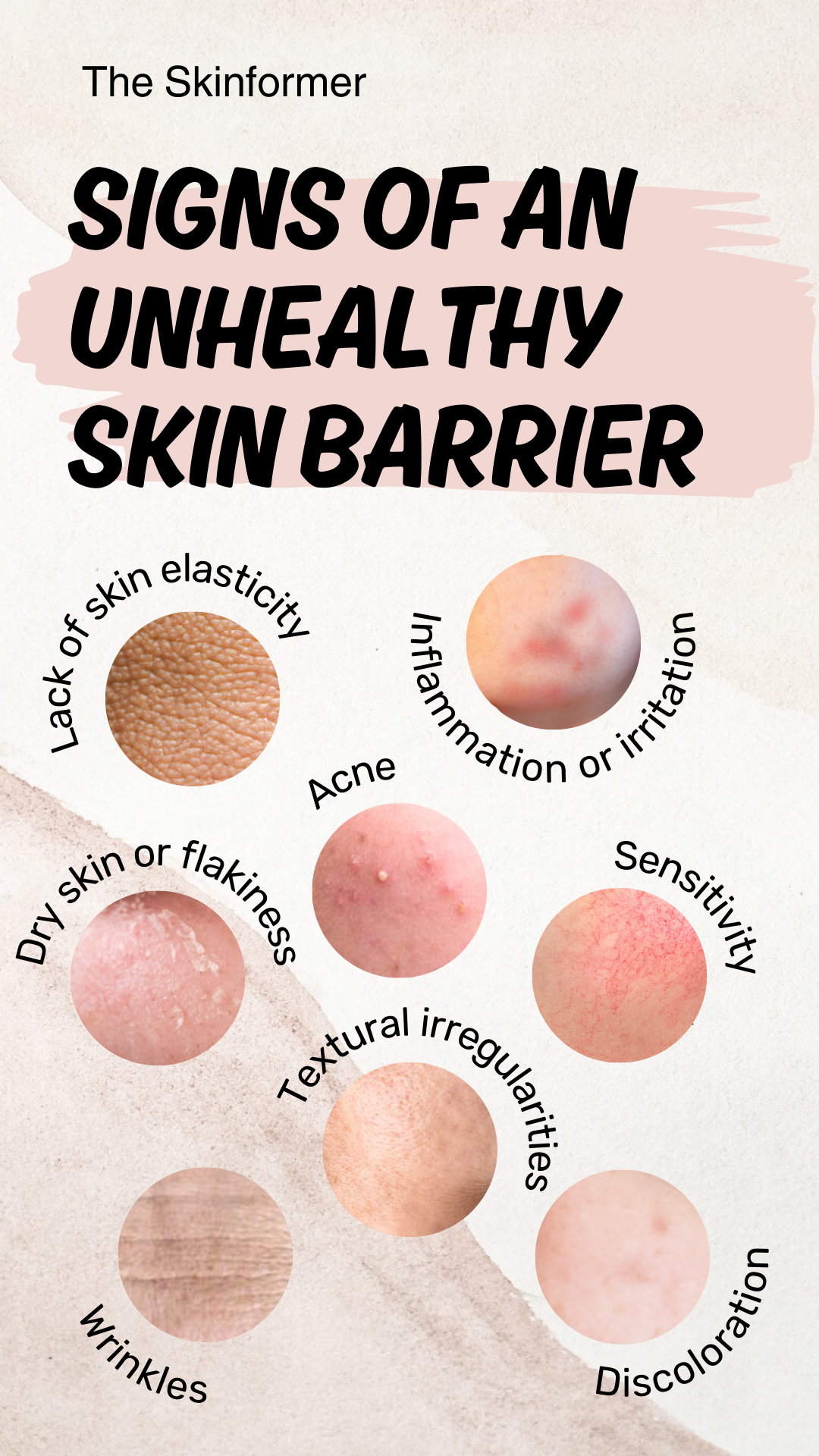 Signs of an unhealthy skin barrier infographic showing lack of elasticity, inflammation, irritation, acne, dry skin, sensitive skin, textural irregularities, wrinkles, and discolouration