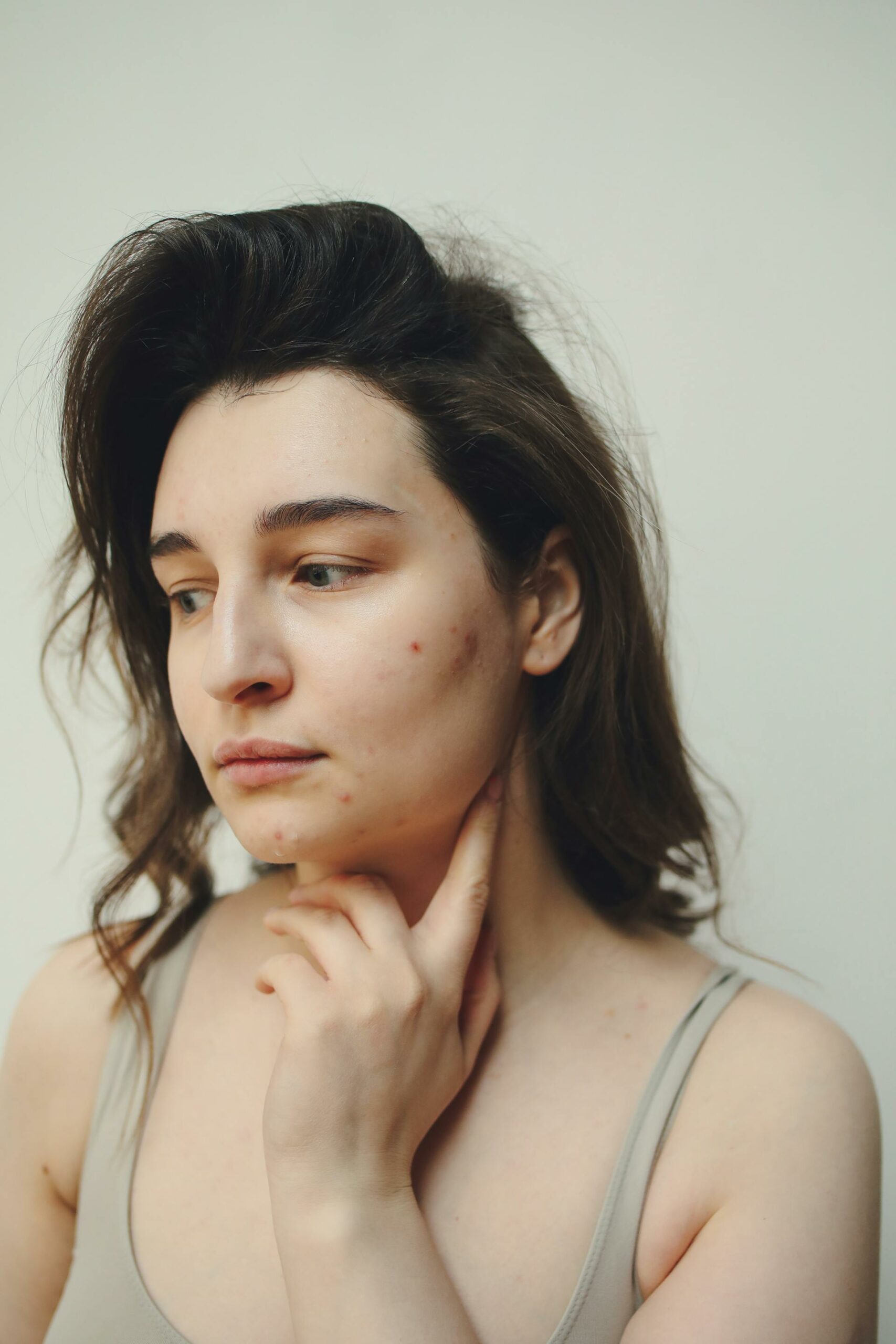 Close of up woman's face showing acne redness on cheek. Woman is downcast because her skin has redness caused by skin blemish.